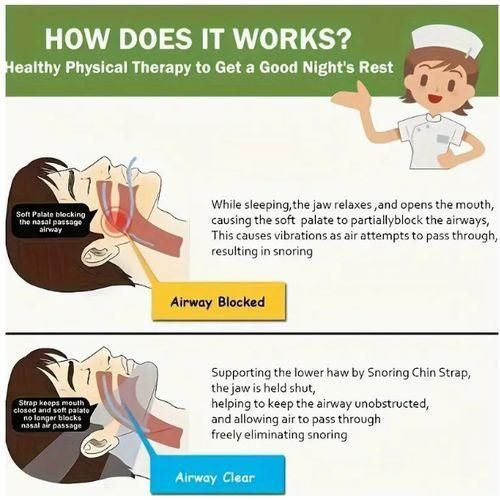 Une sangle à menton conçue pour prévenir les ronflements, une sangle anti-ronflements et un soutien à la mâchoire