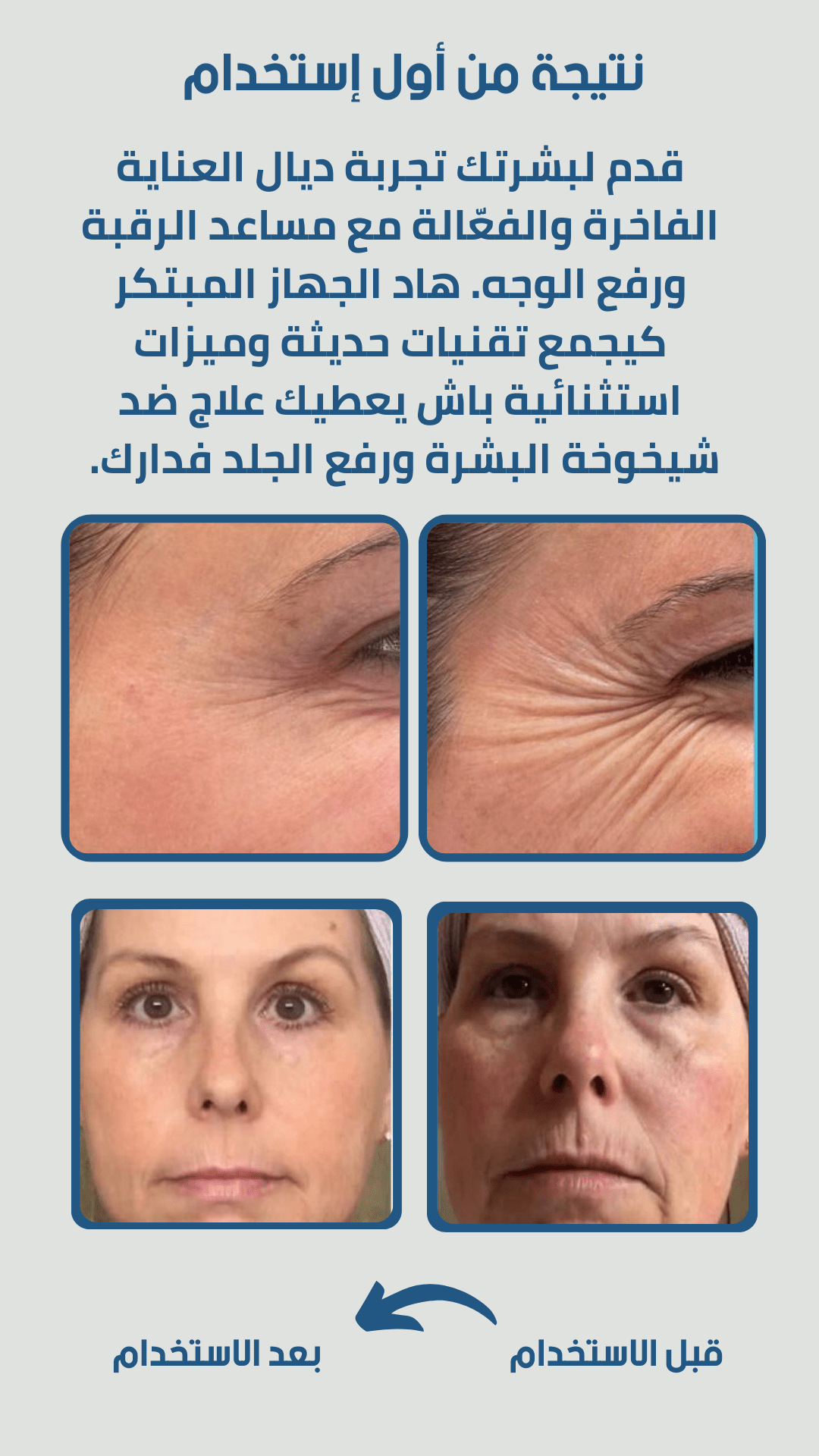 Image de Appareil de beauté du visage anti-rides, micro-courant, photonthérapie EMS - Unbranded