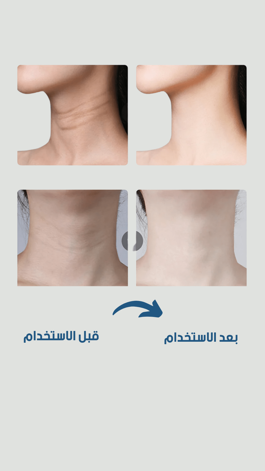 Image de Appareil de beauté du visage anti-rides, micro-courant, photonthérapie EMS - Unbranded