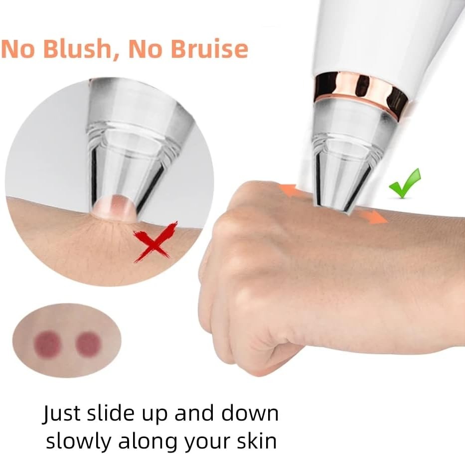 Image de Aspirateur Anti-Points Noirs – Nettoyage Profond de la Peau - Unbranded