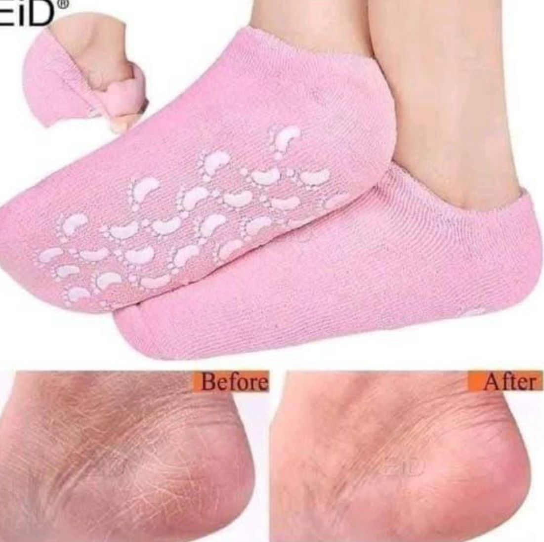 Chaussettes en Gel de Silicone