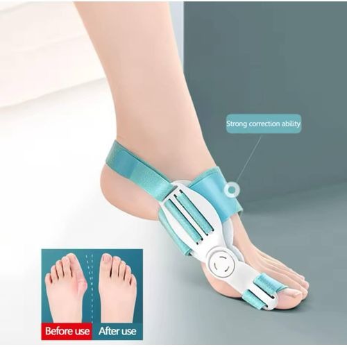 Image de FEETIFIX - Correcteur pour les orteils en Valgus - Unbranded